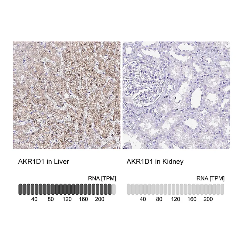 Atlas Antibodies Anti-AKR1D1 Antibody