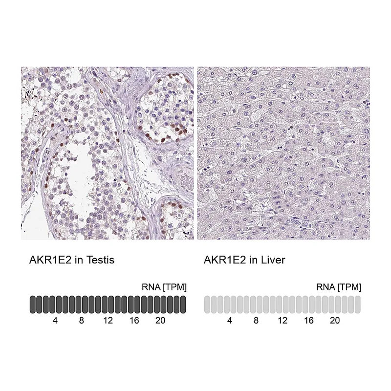 Atlas Antibodies Anti-AKR1E2 Antibody