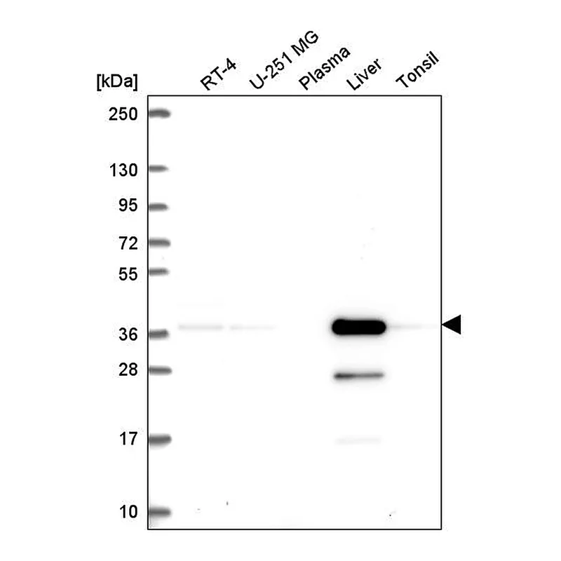 Atlas Antibodies Anti-AKR7A2 Antibody