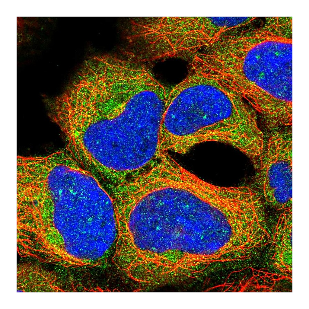 Atlas Antibodies Anti-AKT1S1 Antibody