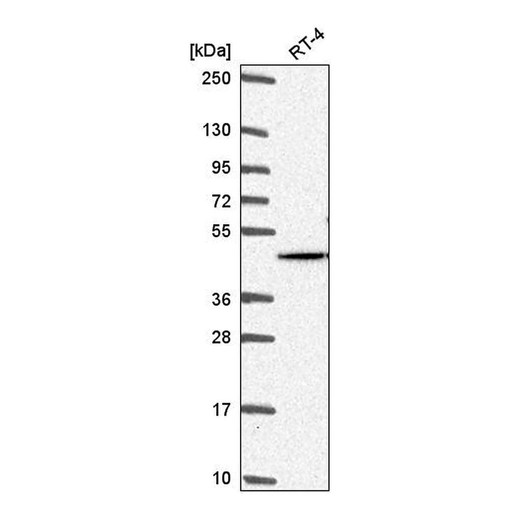 Atlas Antibodies Anti-AKT2 Antibody