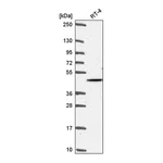 Atlas Antibodies Anti-AKT2 Antibody