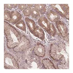 Atlas Antibodies Anti-AKT1S1 Antibody