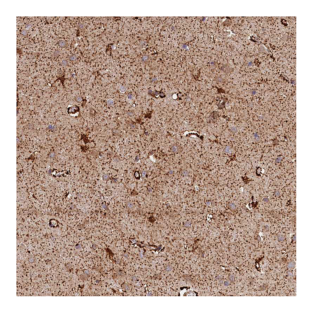 Atlas Antibodies Anti-AKTIP Antibody