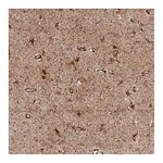 Atlas Antibodies Anti-AKTIP Antibody