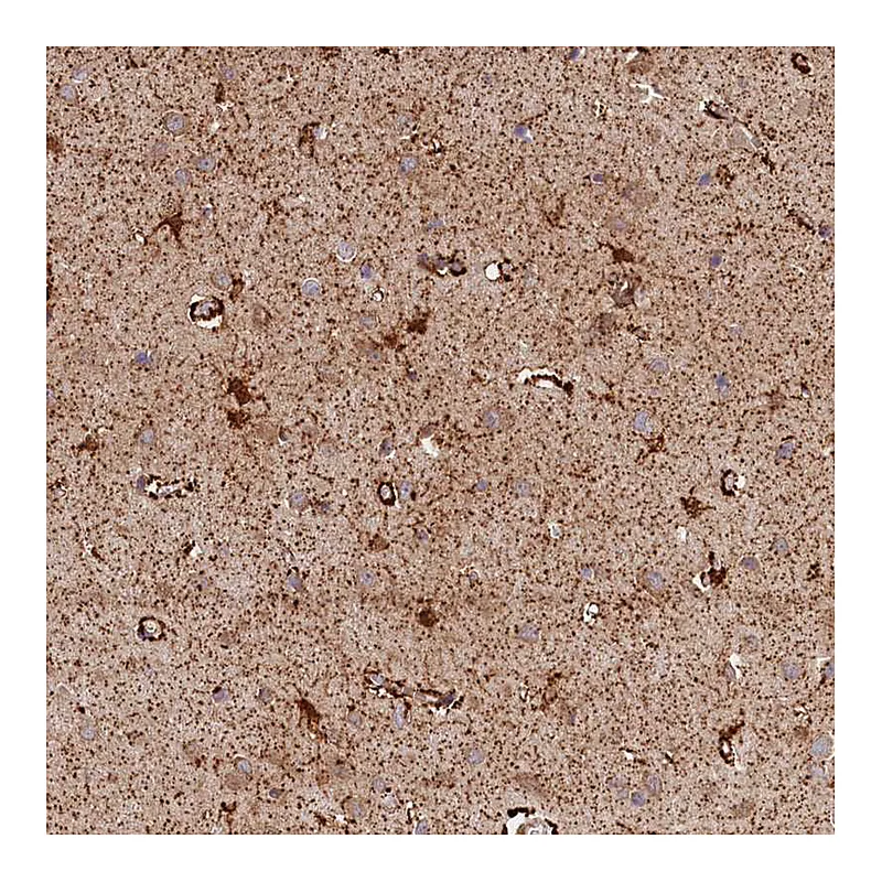 Atlas Antibodies Anti-AKTIP Antibody