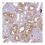 Atlas Antibodies Anti-AL592183.1 Antibody