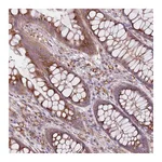 Atlas Antibodies Anti-AKTIP Antibody