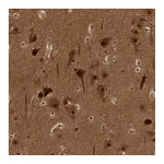 Atlas Antibodies Anti-AKT3 Antibody