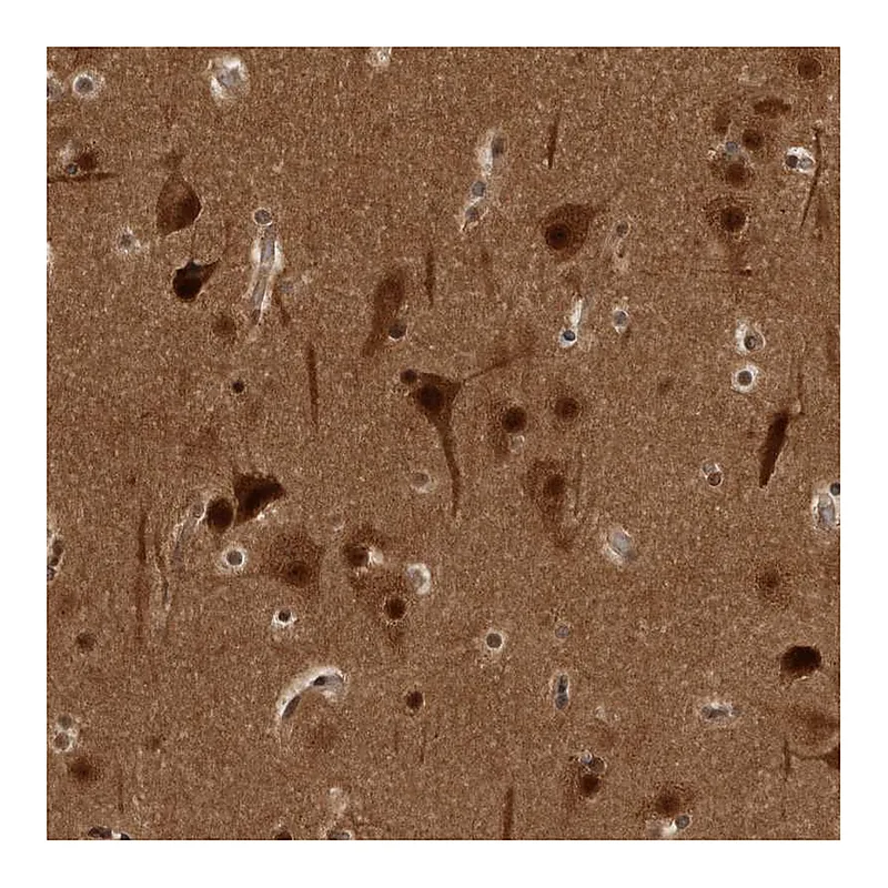 Atlas Antibodies Anti-AKT3 Antibody