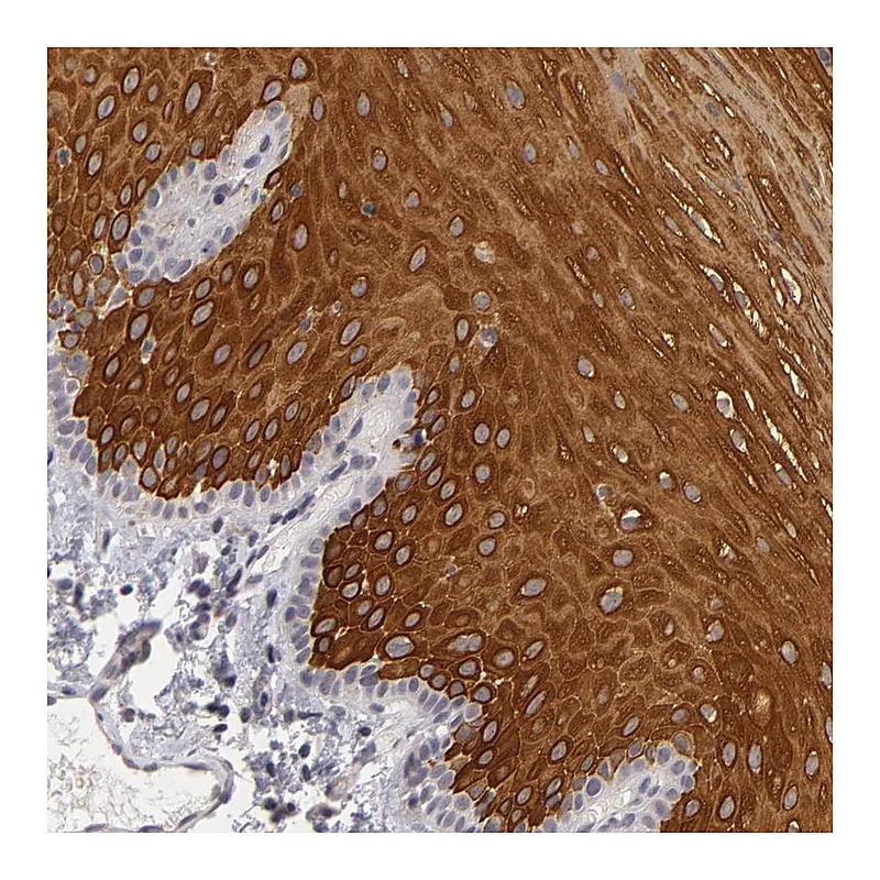 Atlas Antibodies Anti-ALAS2 Antibody