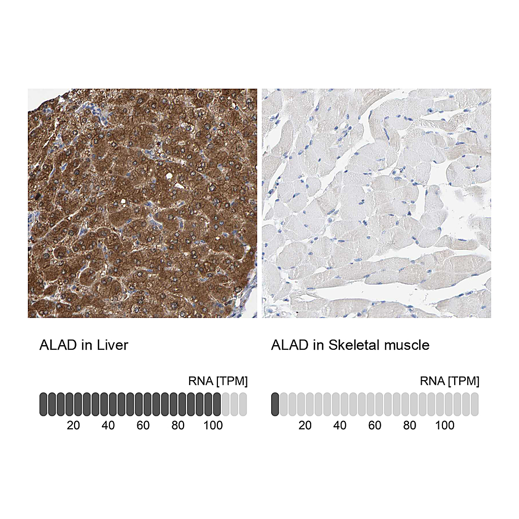 Atlas Antibodies Anti-ALAD Antibody