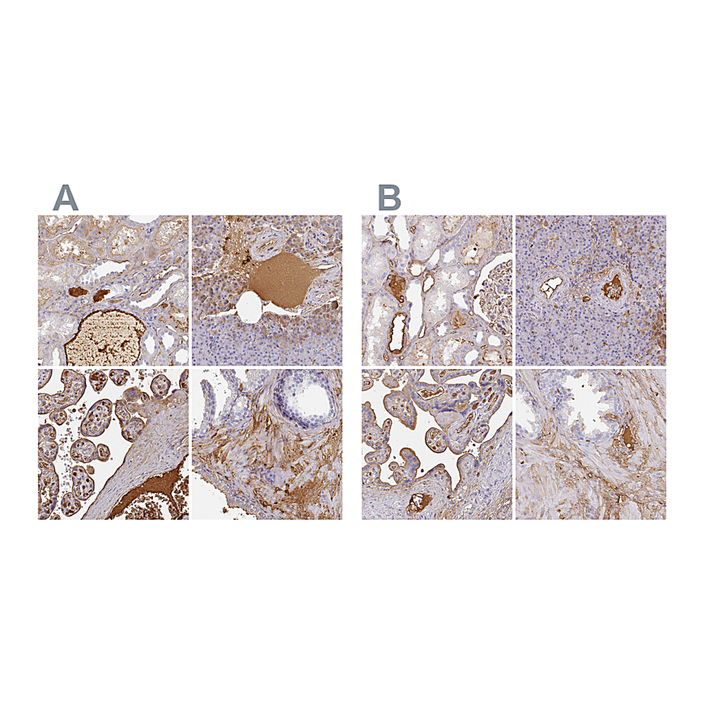 Atlas Antibodies Anti-ALB Antibody