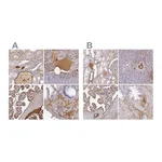 Atlas Antibodies Anti-ALB Antibody