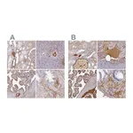 Atlas Antibodies Anti-ALB Antibody