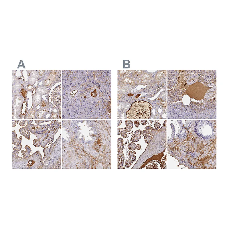 Atlas Antibodies Anti-ALB Antibody