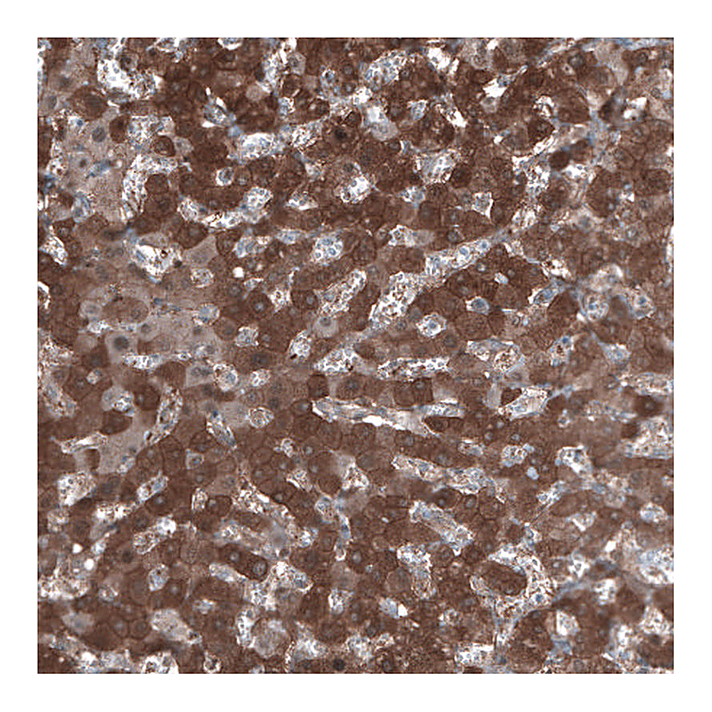 Atlas Antibodies Anti-ALDH1A1 Antibody