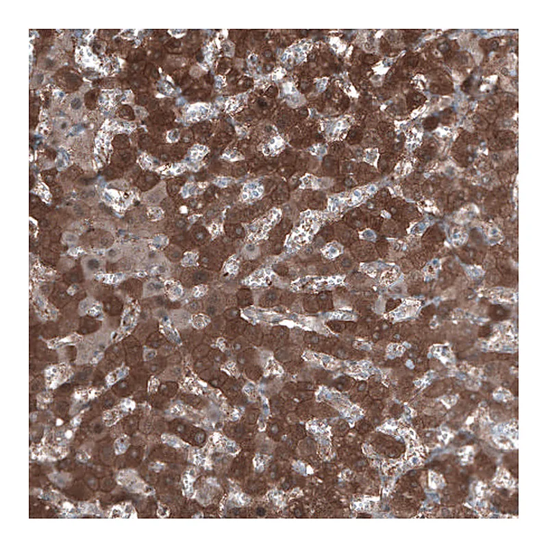 Atlas Antibodies Anti-ALDH1A1 Antibody