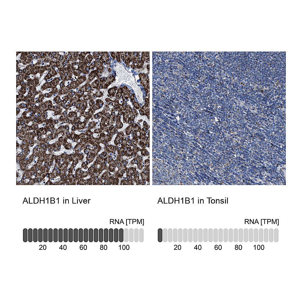 Atlas Antibodies Anti-ALDH1B1 Antibody
