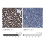 Atlas Antibodies Anti-ALDH1B1 Antibody