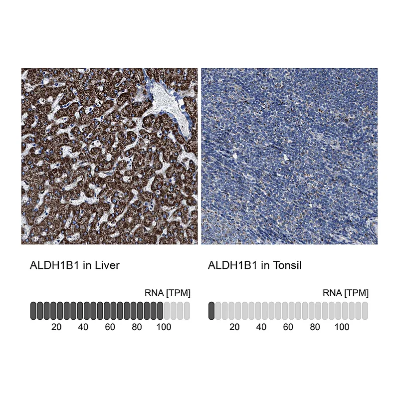 Atlas Antibodies Anti-ALDH1B1 Antibody