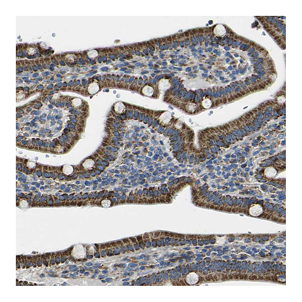 Atlas Antibodies Anti-ALDH18A1 Antibody