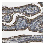 Atlas Antibodies Anti-ALDH18A1 Antibody