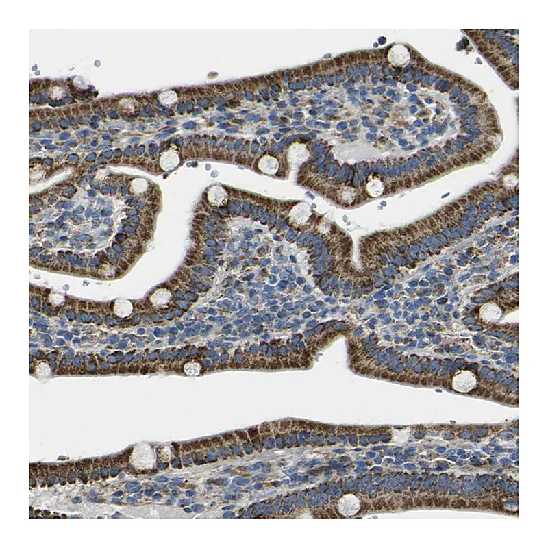 Atlas Antibodies Anti-ALDH18A1 Antibody