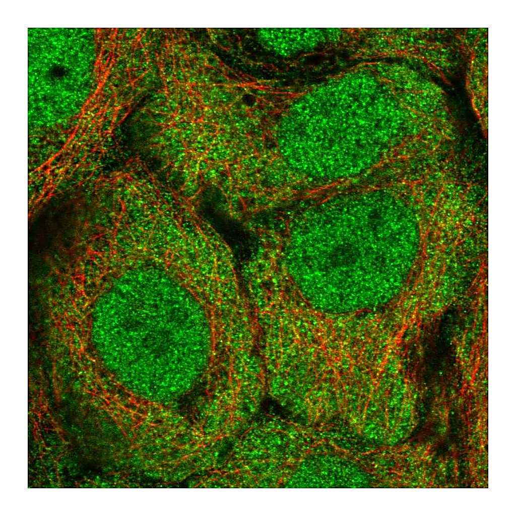Atlas Antibodies Anti-ALDH1A3 Antibody
