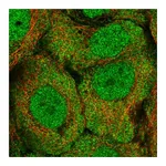Atlas Antibodies Anti-ALDH1A3 Antibody