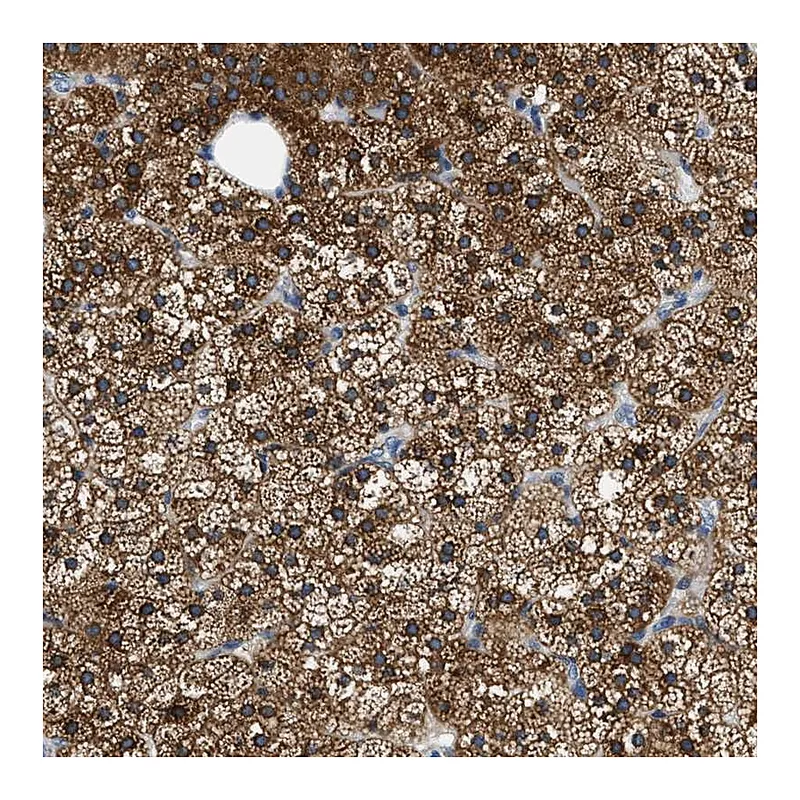Atlas Antibodies Anti-ALDH3A2 Antibody