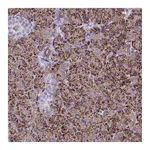 Atlas Antibodies Anti-ALDH1L2 Antibody