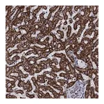 Atlas Antibodies Anti-ALDH1B1 Antibody