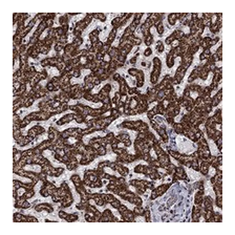 Atlas Antibodies Anti-ALDH1B1 Antibody