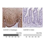 Atlas Antibodies Anti-ALDH3A1 Antibody