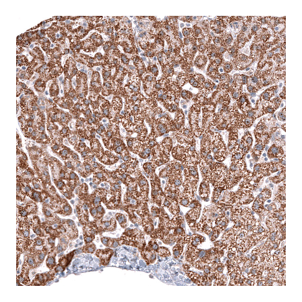 Atlas Antibodies Anti-ALDH2 Antibody