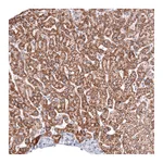 Atlas Antibodies Anti-ALDH2 Antibody