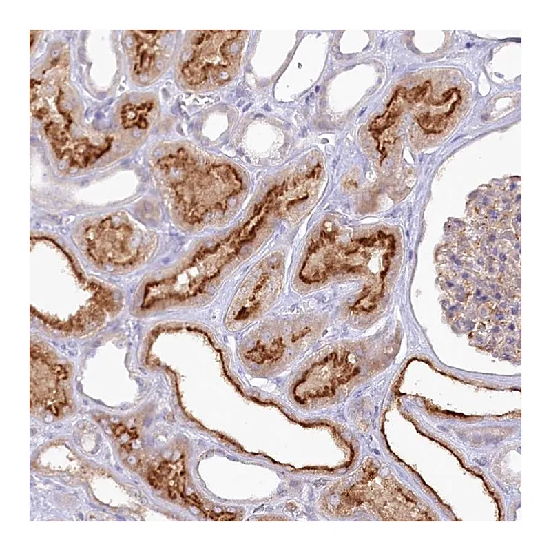 Atlas Antibodies Anti-ALDH3B1 Antibody