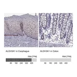 Atlas Antibodies Anti-ALDH3A1 Antibody