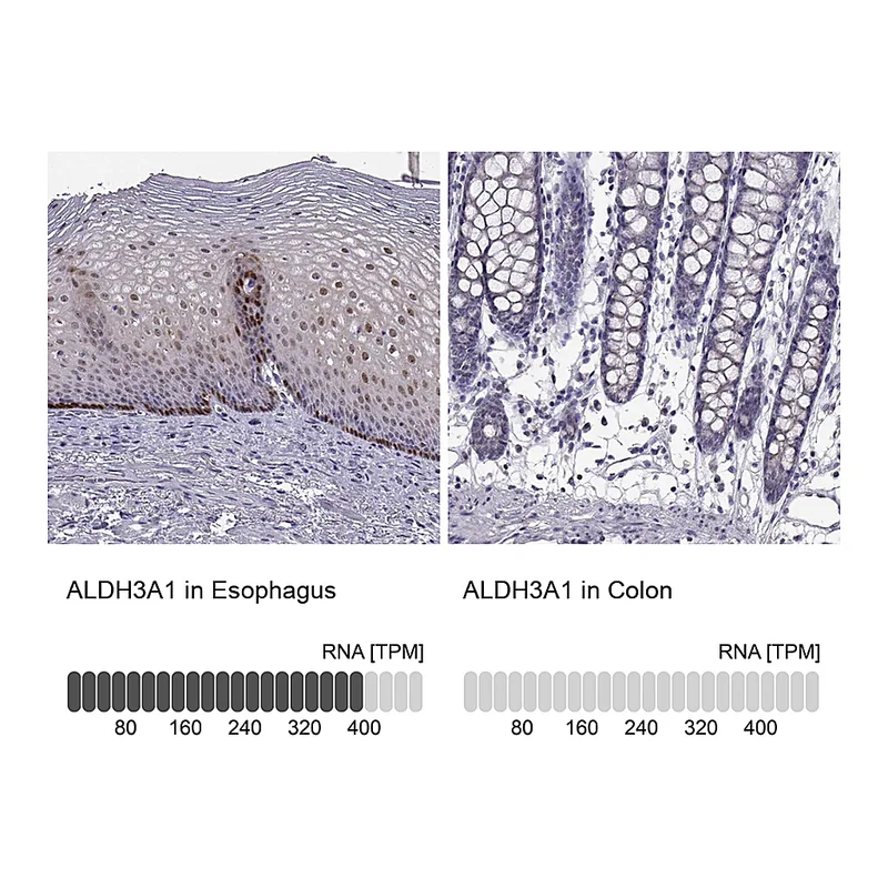 Atlas Antibodies Anti-ALDH3A1 Antibody