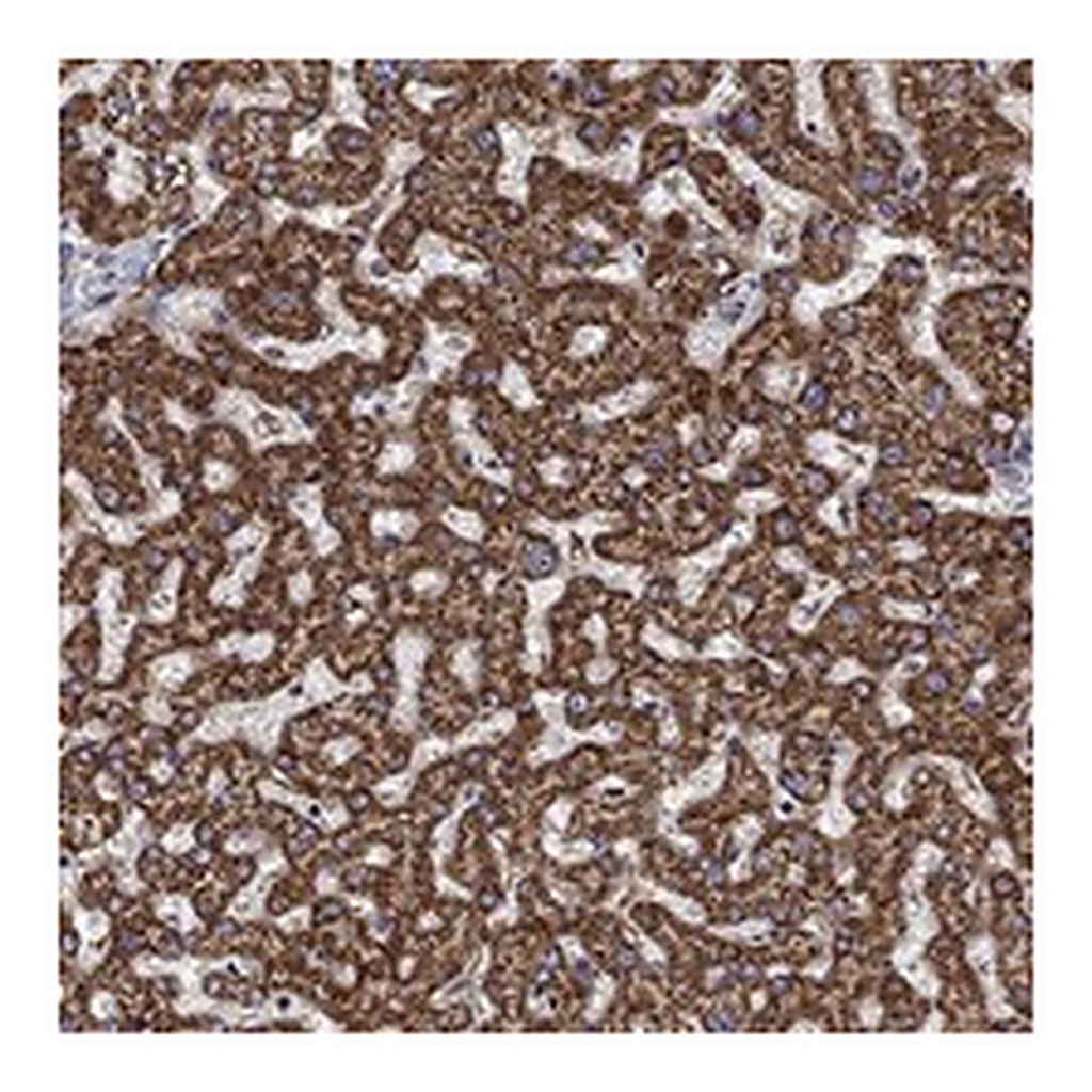 Atlas Antibodies Anti-ALDH4A1 Antibody