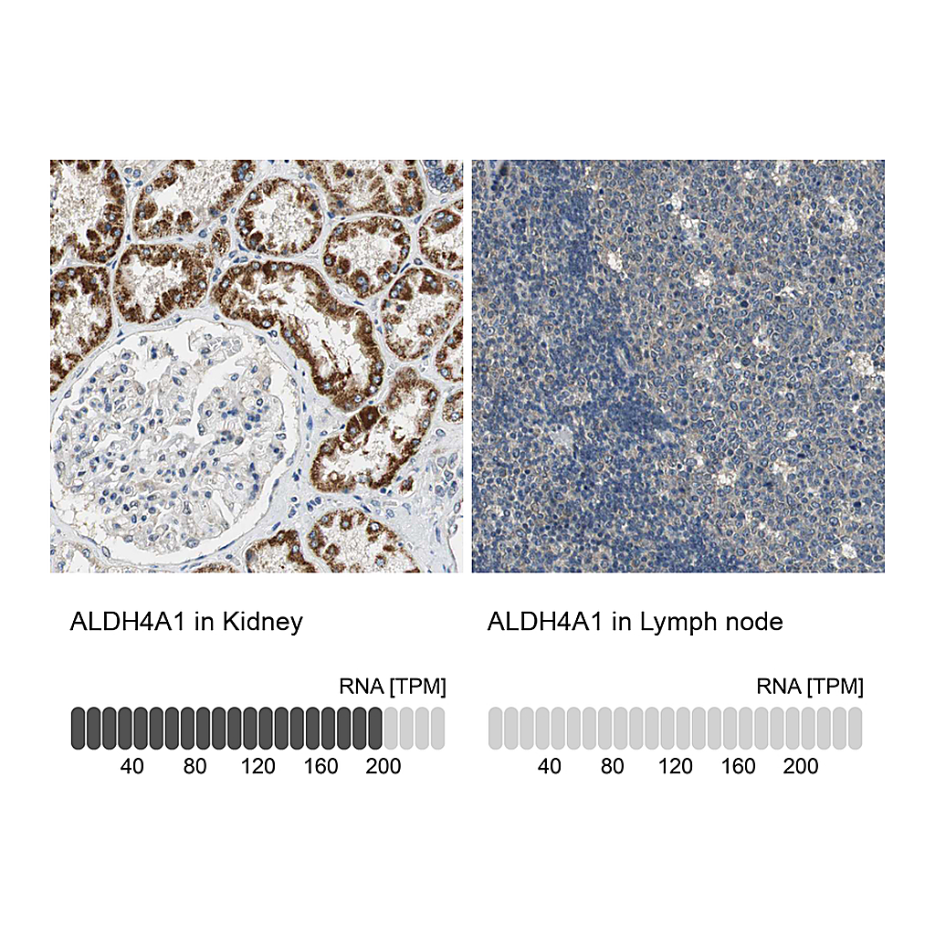 Atlas Antibodies Anti-ALDH4A1 Antibody