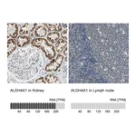 Atlas Antibodies Anti-ALDH4A1 Antibody