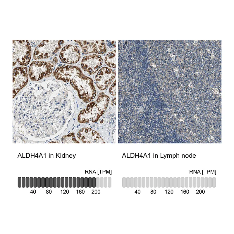 Atlas Antibodies Anti-ALDH4A1 Antibody