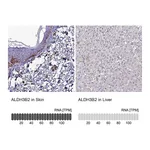 Atlas Antibodies Anti-ALDH3B2 Antibody