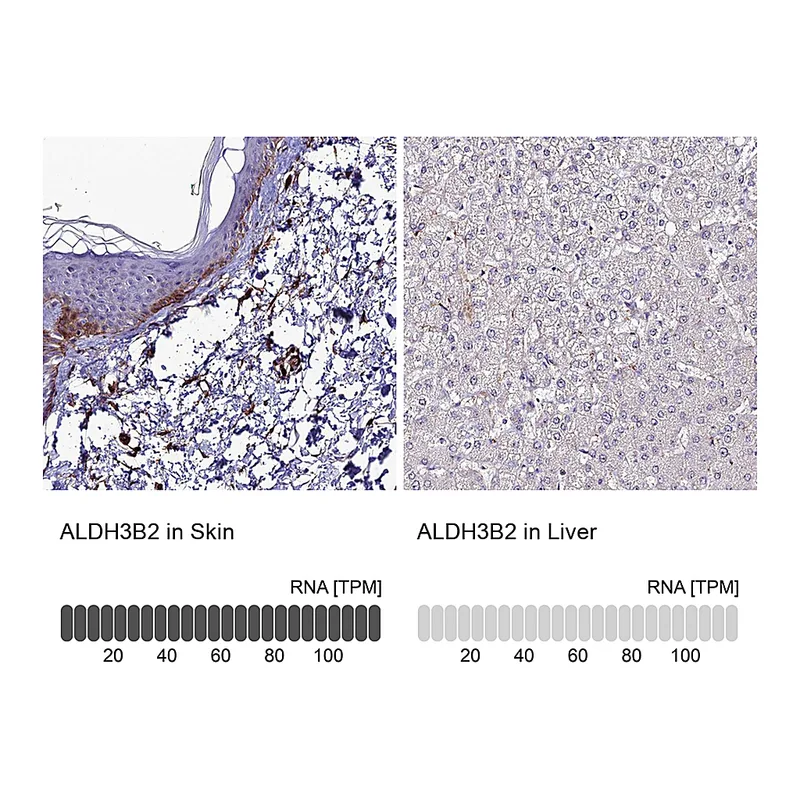 Atlas Antibodies Anti-ALDH3B2 Antibody
