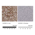 Atlas Antibodies Anti-ALDH5A1 Antibody