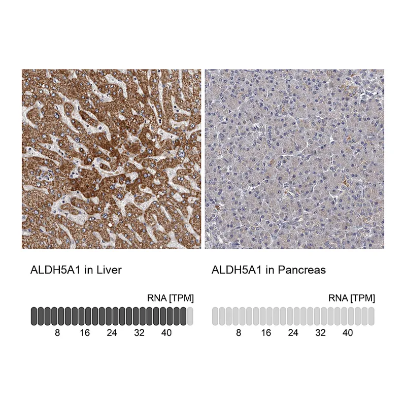 Atlas Antibodies Anti-ALDH5A1 Antibody