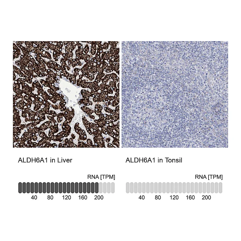 Atlas Antibodies Anti-ALDH6A1 Antibody