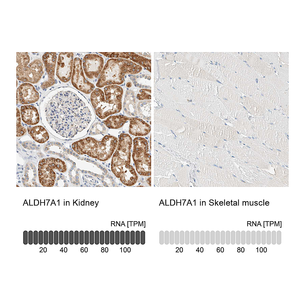 Atlas Antibodies Anti-ALDH7A1 Antibody